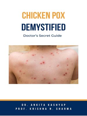 cover image of Chickenpox Demystified